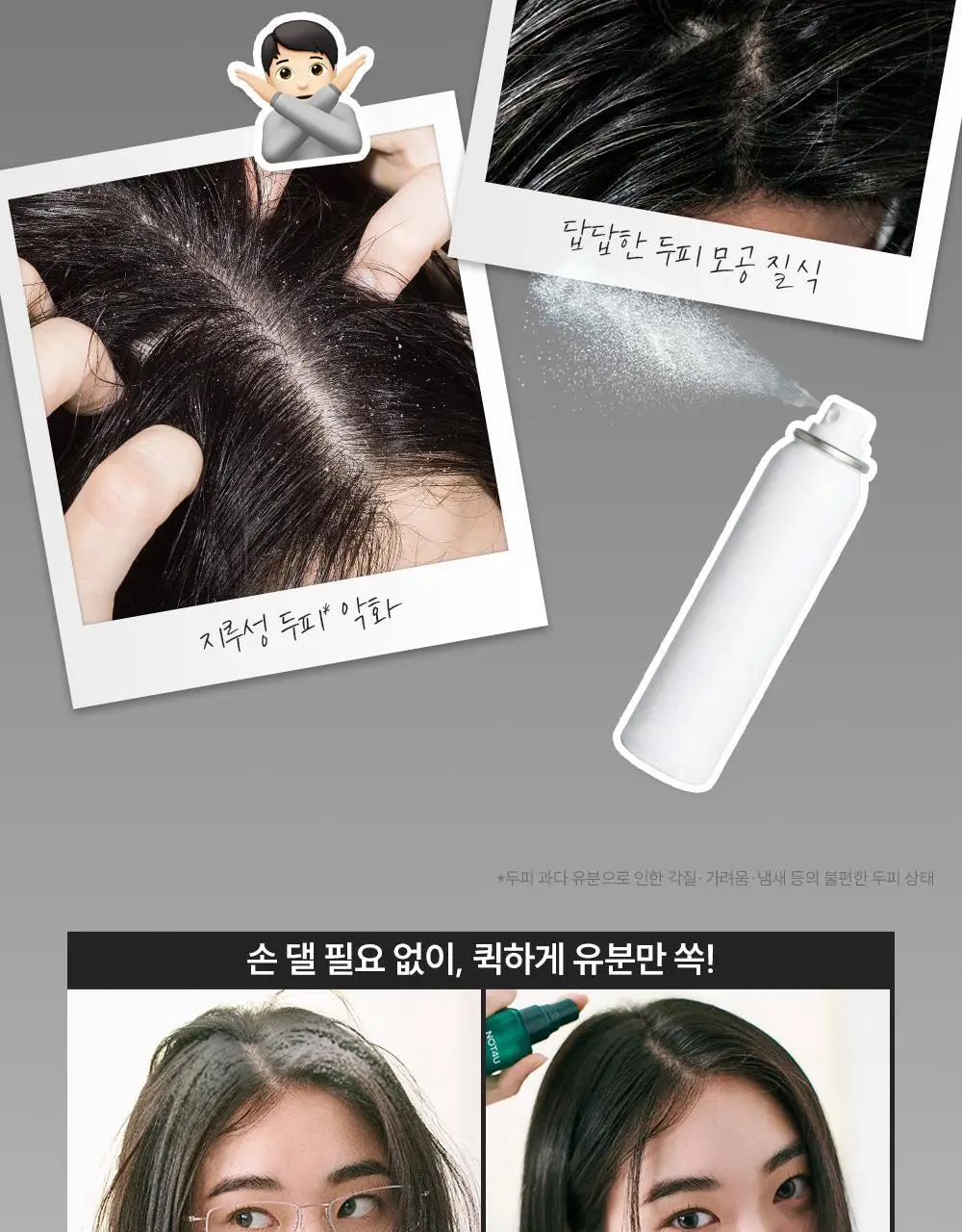 [지루성 두피케어] 낫포유 지성두피 트러블케어 미스트 80ml 기획 (+미니어처 30ml) 상세페이지 13